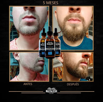 Combo | Crecimiento acelerado de barba