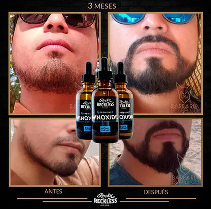 Combo | Crecimiento acelerado de barba