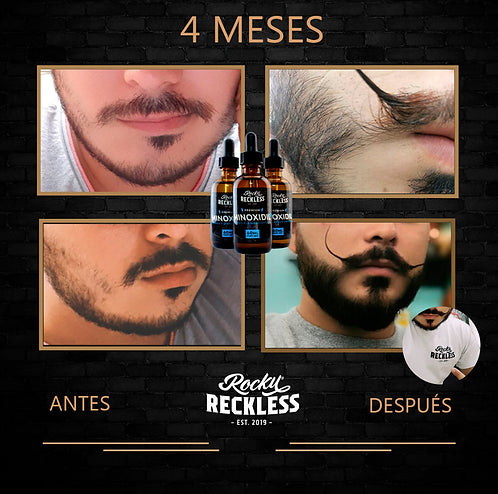 Combo | Crecimiento acelerado de barba