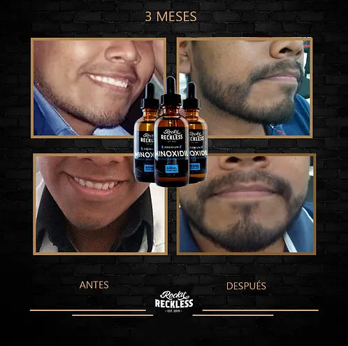 Combo | Crecimiento acelerado de barba