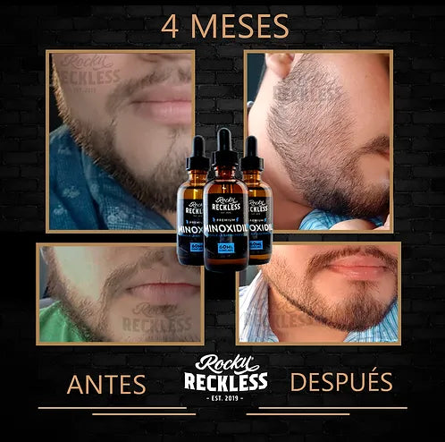 Combo | Crecimiento acelerado de barba